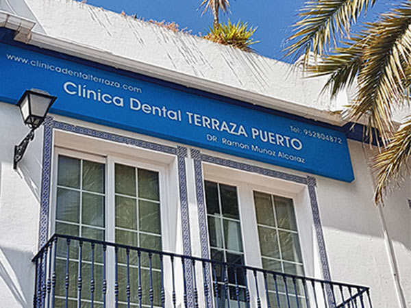 Teléfono de Urgencias Dentista en Estepona