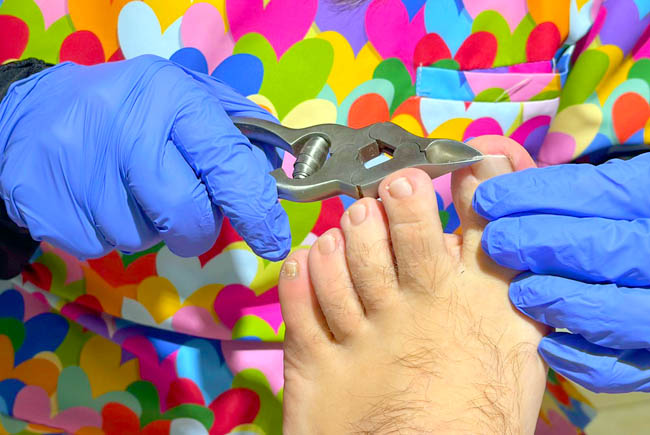 Podología especialista en pie diabético